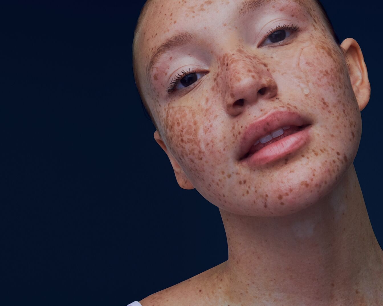 Primer plano del rostro de una mujer con pecas, resaltando su belleza natural y la textura de su piel.