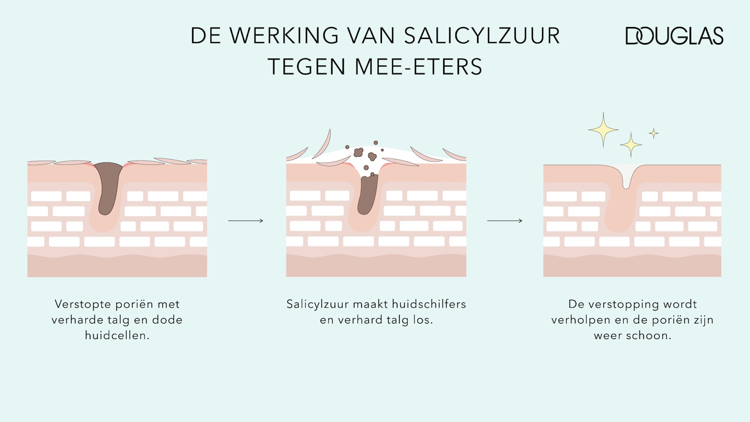 Diagram illustrating how salicylic acid works against blackheads, showing the process of unclogging pores and cleaning the skin.
