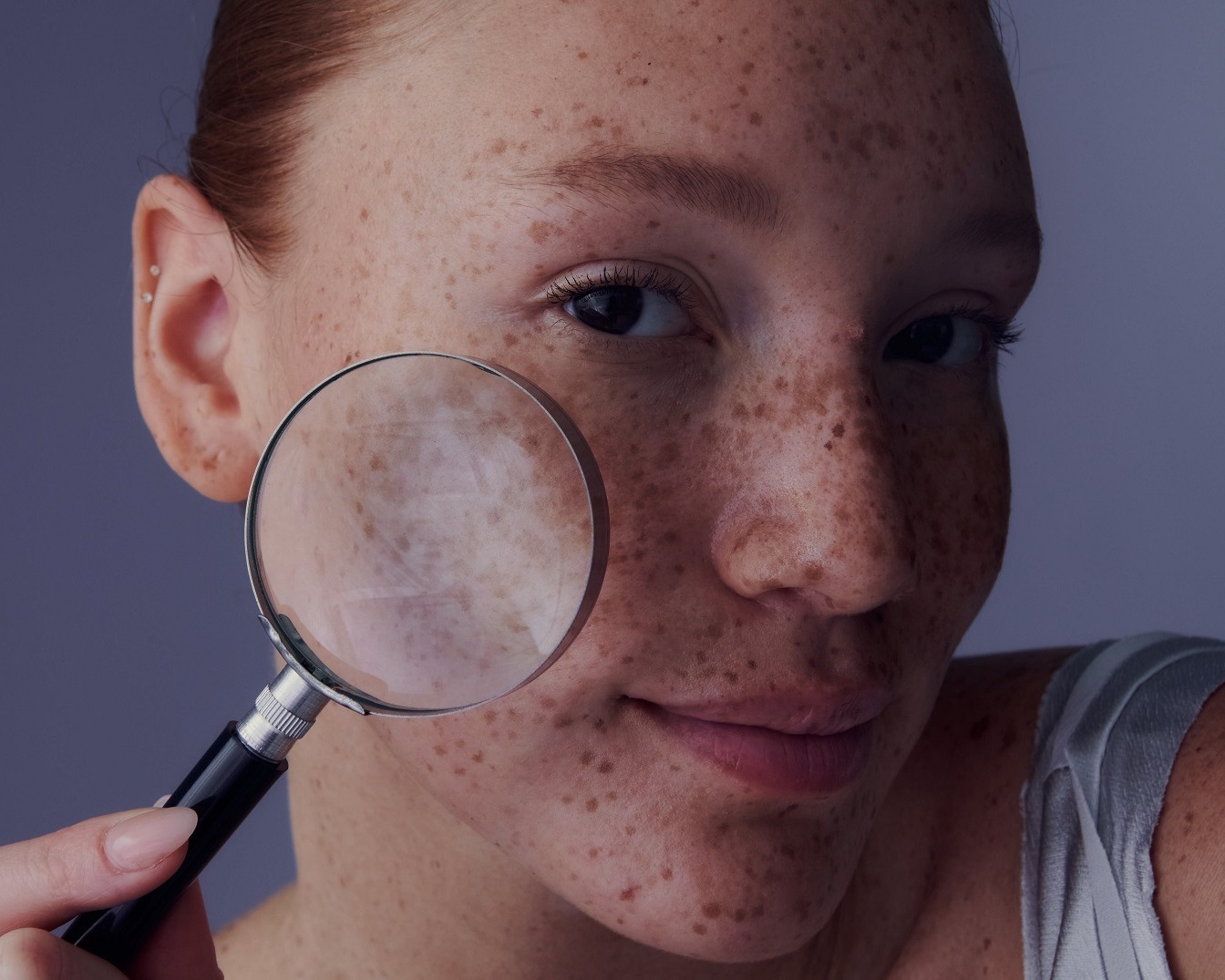 Nahaufnahme eines jungen, lächelnden Frauenporträts mit Sommersprossen, die eine Lupe vor ihr Gesicht hält, um ihre Haut zu untersuchen.