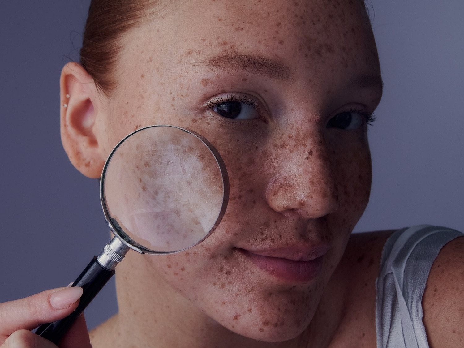 Nahaufnahme eines Gesichtes mit Sommersprossen, das mit einer Lupe betrachtet wird, um Hautdetails hervorzuheben.