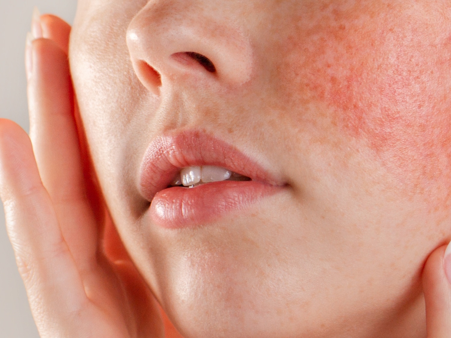 Primo piano di una donna con la pelle chiara, guancia arrossata e labbra carnose, che tocca delicatamente il suo viso.