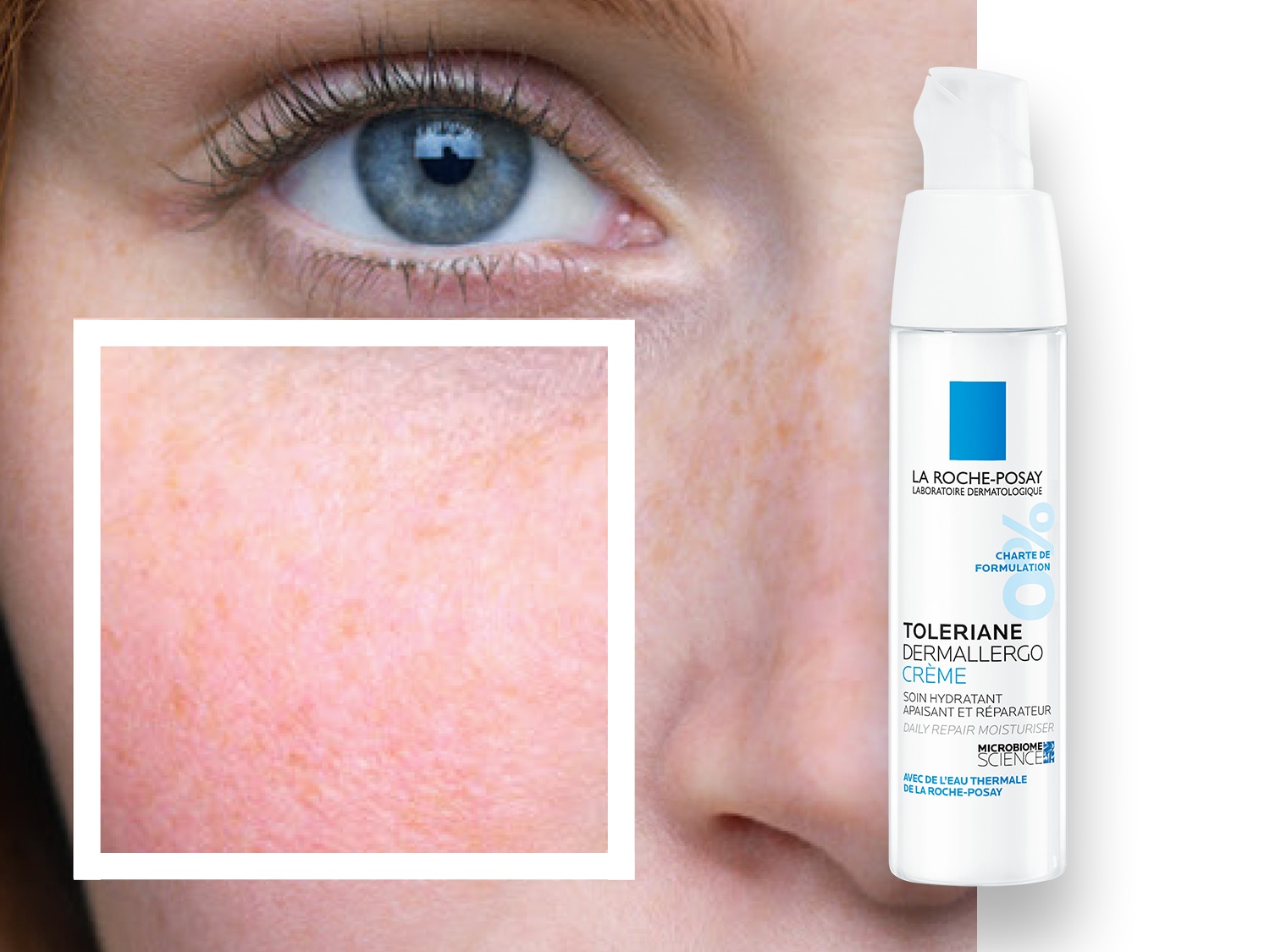 Primo piano di un viso femminile con un occhio azzurro e una porzione di pelle ingrandita, accanto a un flacone bianco di crema idratante La Roche-Posay Toleriane Dermallergo.
