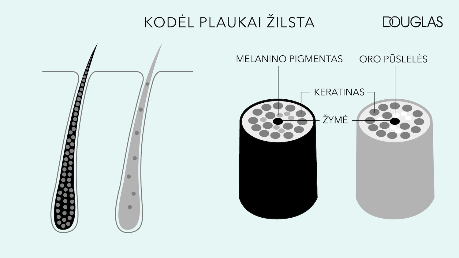 Iliustracija, kurioje pavaizduota plauko struktūra su melanino pigmentais ir oro pūslelėmis, paaiškinanti, kodėl plaukai žilsta.