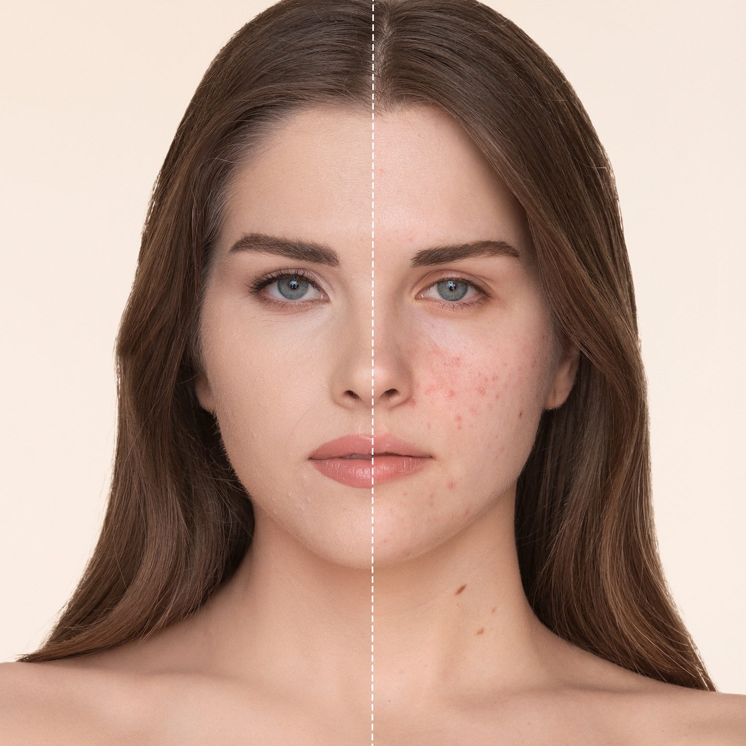 Vorher-Nachher-Vergleich: Eine Gesichtshälfte zeigt Haut mit Rötungen und Unreinheiten, die andere Hälfte zeigt einen ebenmäßigen Teint nach der Anwendung von Make-up.