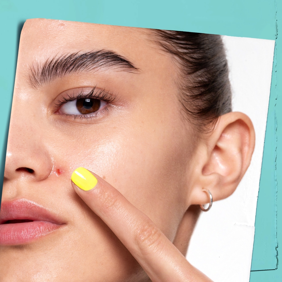 Gros plan sur le visage d'une femme avec un bouton sur le nez, qu'elle touche avec un doigt au vernis jaune.