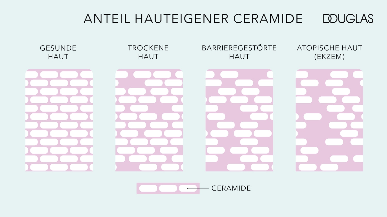 Die Grafik von Douglas zeigt den Anteil hauteigener Ceramide bei gesunder, trockener, barrieregestörter und atopischer Haut (Ekzem).