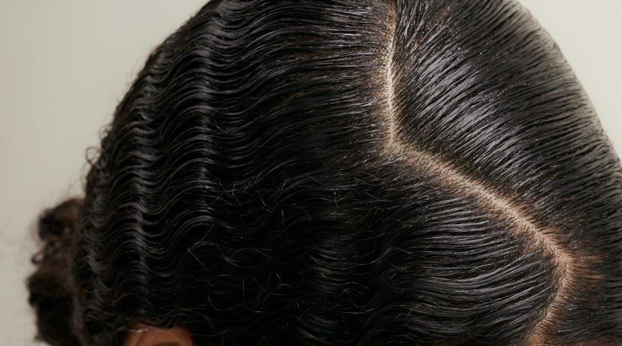 Let\'sTalkHairCare: Trockene Kopfhaut ✔️ online kaufen | DOUGLAS
