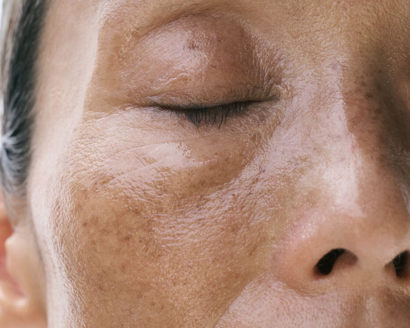 Nahaufnahme eines Frauengesichts mit geschlossenen Augen, auf dem eine glänzende Creme aufgetragen ist, die Hautunreinheiten und Falten betont.