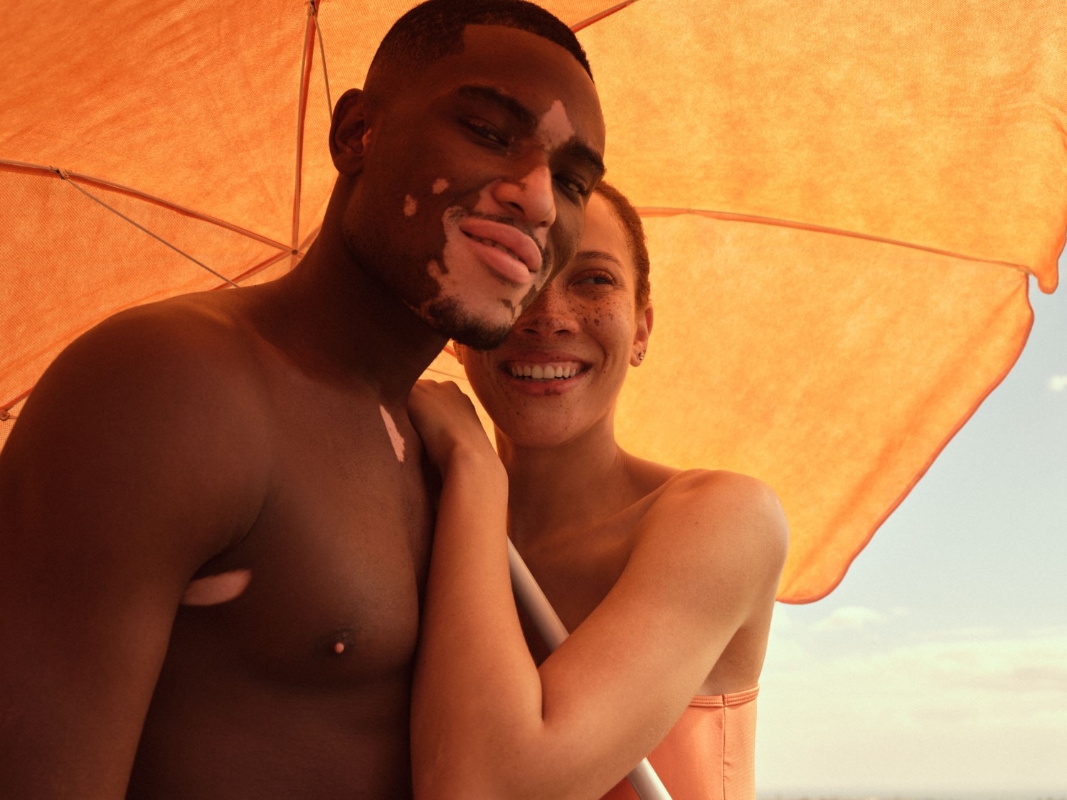 Ein lächelndes Paar, ein Mann mit Vitiligo, steht unter einem orangefarbenen Sonnenschirm und genießt die Sonne.