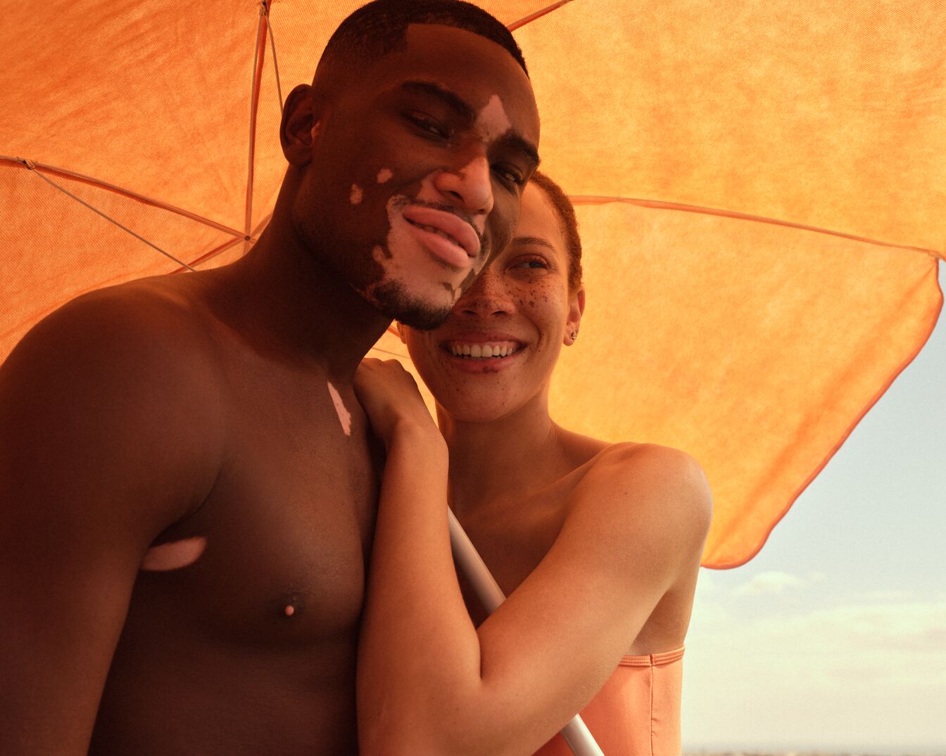 Ein strahlendes Paar, er mit Vitiligo, sie mit Sommersprossen, lacht unter einem orangefarbenen Sonnenschirm, der einen warmen Schein auf ihre Gesichter wirft.