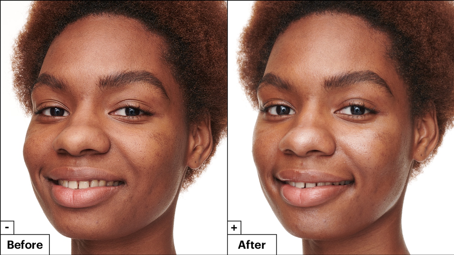 Een close-up van een lachende vrouw met een donkere huid, verdeeld in een 'voor' en 'na' sectie, waarbij de 'na' sectie een egalere teint laat zien.